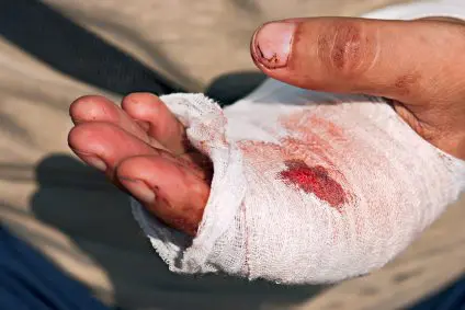 Medicine bandage on human injury hand after accident with chains