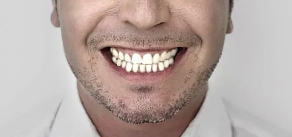 fakesmile-pano_23567